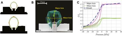 Soft Robotic Deployable Origami Actuators for Neurosurgical Brain Retraction